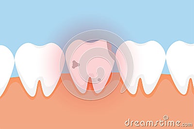 Bad tooth hurting with red danger glow effect vector. A dead tooth vector with a red glow effect. A dead tooth with cavities Vector Illustration