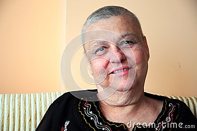 Bald (ill) woman Stock Photo