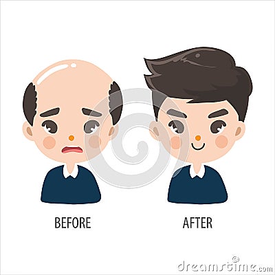 Bald man without confidence and long hair men look more handsome Vector Illustration