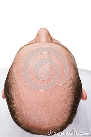 Bald man head Stock Photo