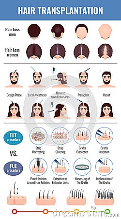 Baldness Hair Transplantation Set Vector Illustration