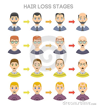 Baldness stages vector set. Vector Illustration