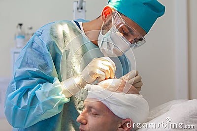 Baldness treatment. Hair transplant. Surgeons in the operating room carry out hair transplant surgery. Surgical Stock Photo
