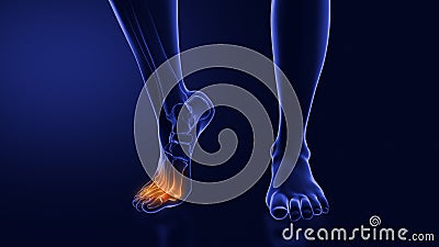 Ball of foot pain or Metatarsalgia Stock Photo