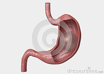 Balloon gastric. inflatable device that is placed in the stomach to reduce weight Stock Photo