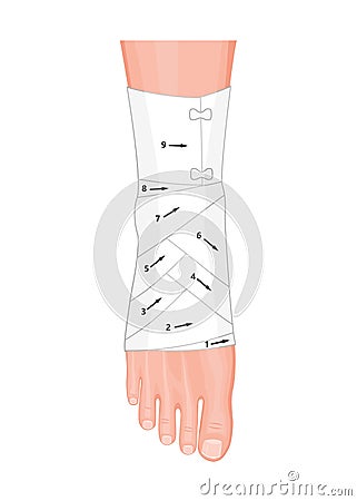 Bandage Ankle Vector Illustration