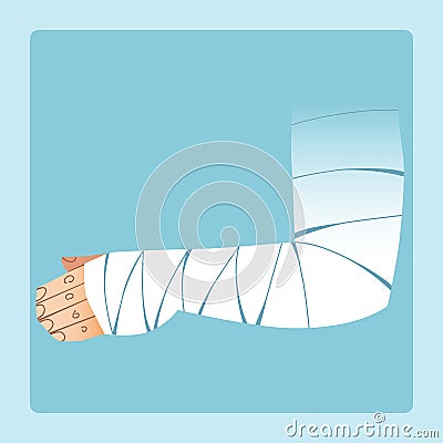 Bandaged hand after fracture or injury Stock Photo