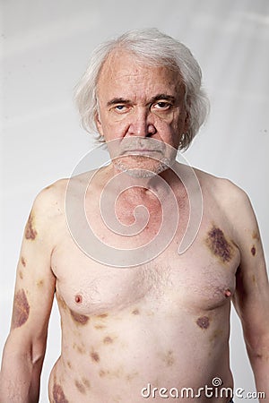 Bandits mutilated man Stock Photo