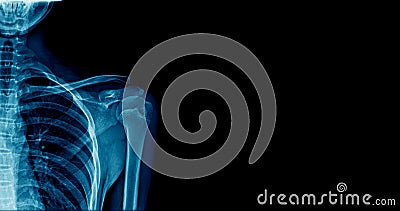 Banner shoulder x-ray Stock Photo