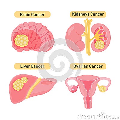 Cancer types flat illustration. Cartoon Illustration