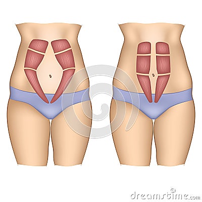 Abdominal muscles on a woman belly Vector Illustration