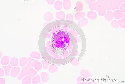 Basophils Stock Photo