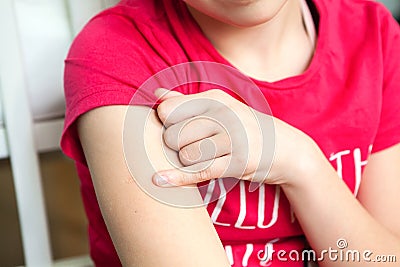 BCG is vaccination on female shoulder, close up view Stock Photo