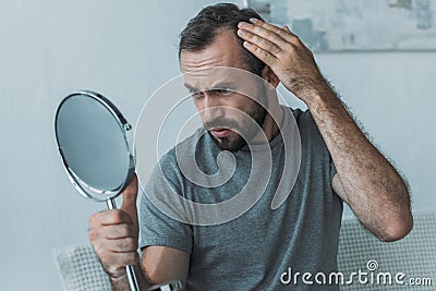 bearded middle aged man with alopecia looking at mirror hair loss Stock Photo