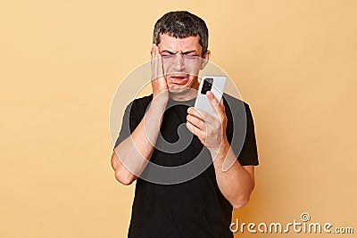 Beaten traumatized man in black T-shirt with bruises and abrasions on his face isolated over beige background holding smartphone Stock Photo