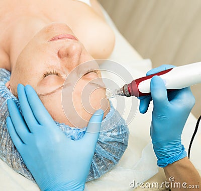 Beautician makes fractional mesotherapy to young woman. The cosmetic procedures for the face. Beauty treatments in the Stock Photo