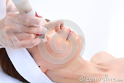 Needle Mesotherapy, face lift Stock Photo