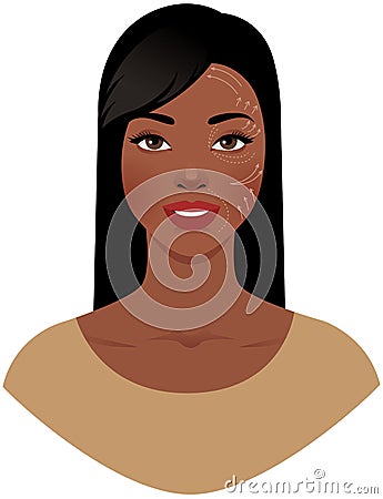 Beautiful African American woman with marks drawn on her face for plastic cosmetic surgery vector illustration Vector Illustration