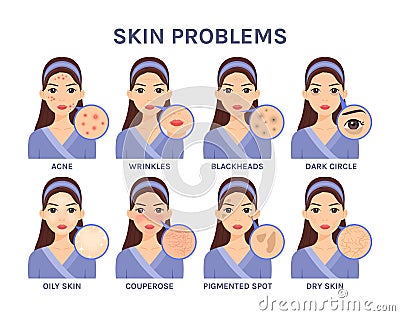 Beautiful cartoon Woman and Skin Problems.Portrait of a Girl and close-up of facial Diseases: Acne, Blackheads, Wrinkles, Dark Vector Illustration