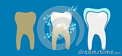 Beautiful flat dentist vector set of teeth cleansing process with decayed, cleansed and white shiny teeth on blue background Vector Illustration