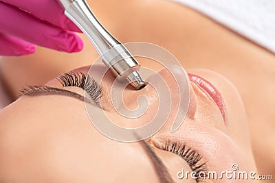 Beautiful girl with clean fresh skin.Cosmetologist makes procedure microdermabrasion on the face against acne and blackheads on Stock Photo