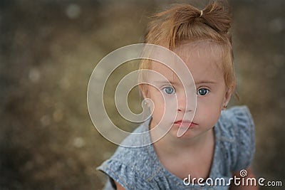 Beautiful girl with Down syndrome on the beach Stock Photo