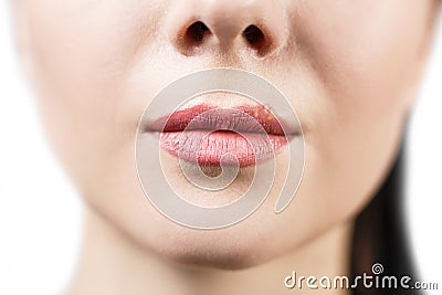 Beautiful lips infected herpes virus Stock Photo