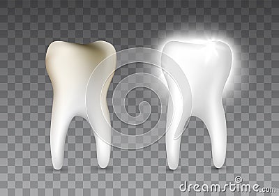 Beautiful realistic dentist vector set of decayed and white shiny tooth on transparent background Vector Illustration