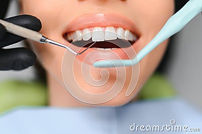 Beautiful Smile With White Teeth. Closeup Of Smiling Woman Mouth With Natural Plump Full Lips And Healthy Perfect Smile Stock Photo