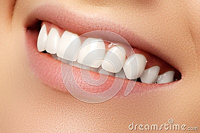 Beautiful smile with whitening teeth. Dental photo. Macro closeu Stock Photo