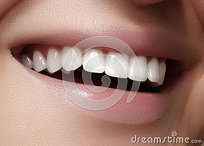 Beautiful smile with whitening teeth. Dental photo. Macro closeup of perfect female mouth, lipscare rutine Stock Photo