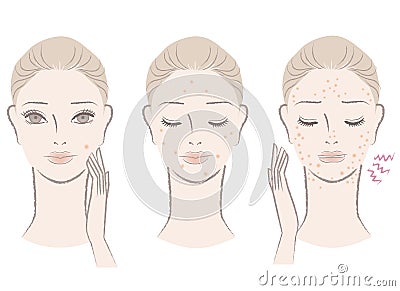 Beautiful woman with annoying pimples Vector Illustration