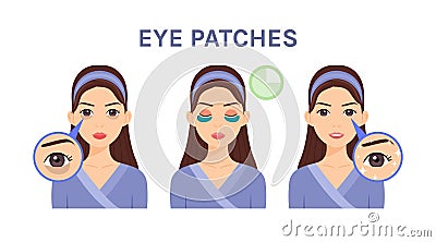 Beautiful Woman and Dark Circles under Eyes. Cute Girl uses Patches for Puffiness, and Skin Problems. Steps. Before, After. Fair Vector Illustration