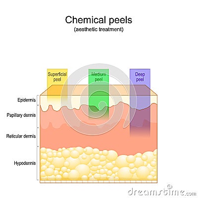 Beauty aesthetic treatment. Chemical peels Vector Illustration