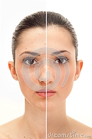 Beauty concept before and after retouch Stock Photo