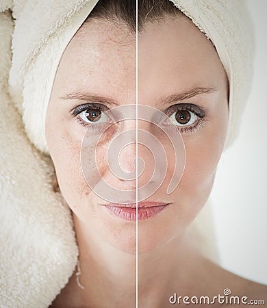 beauty concept - skin care, anti-aging procedures, rejuvenation, lifting, tightening of facial skin Stock Photo