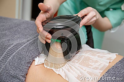 Beauty therapist applying cryolipolysis treatment. Non-surgical fat reduction Stock Photo