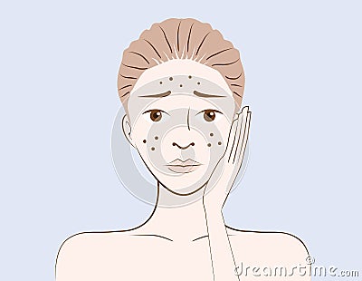 Beauty women have problem acne skin Vector Illustration