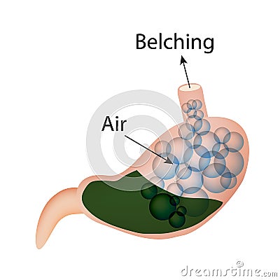 Belching. Air in the stomach. The structure of the esophagus and stomach. Infographics. Vector illustration Vector Illustration