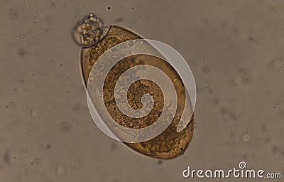 Big size Fasciola parasite egg. Stock Photo