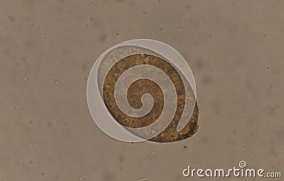 Big size Fasciola parasite egg. Stock Photo