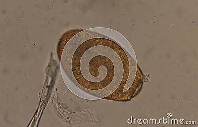 Big size Fasciola parasite egg. Stock Photo