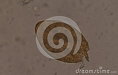 Big size Fasciola parasite egg. Stock Photo