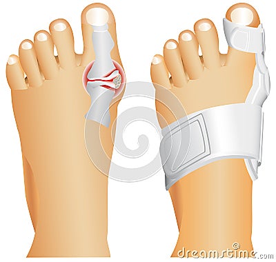 Big toe injury Stock Photo