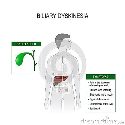 Biliary dyskinesia. Vector illustration for medical use Vector Illustration