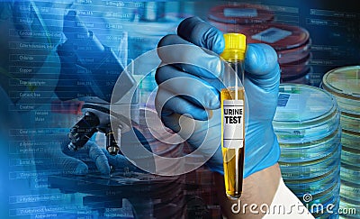 Biochemist with pee tube for urinalysis in the lab and background microscopist working with samples at microscope Stock Photo