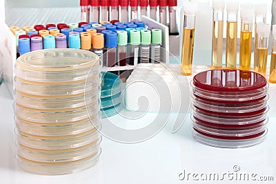 Biological sample on the workbench in the microbiology laboratory Stock Photo