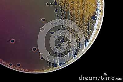 Black bacterial colonies of Salmonella species on Salmonella Shigella agar (SS agar, selective and differential medium) plate on Stock Photo