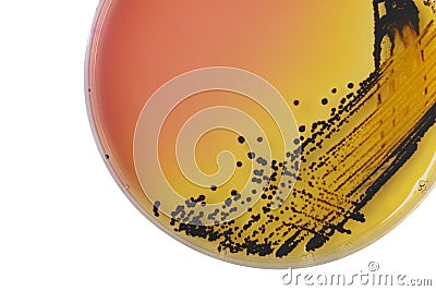 Black bacterial colonies of Salmonella species on Salmonella Shigella agar (SS agar, selective and differential medium) plate on Stock Photo