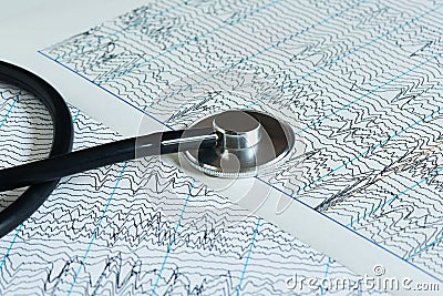 A black stethoscope on two EEG papers Stock Photo